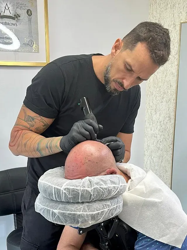 Un hombre se está haciendo un tatuaje en la cabeza de un hombre calvo.