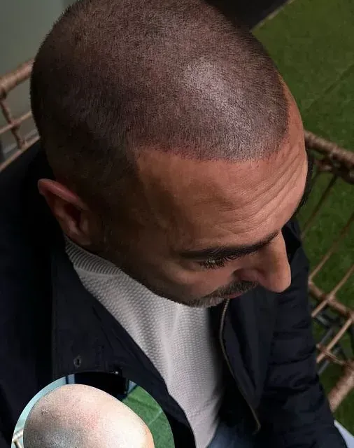 Un hombre con la cabeza rapada está sentado en una silla.