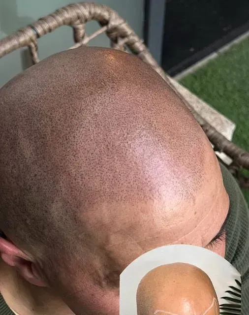 Un hombre con la cabeza calva está sentado en una silla.