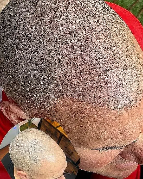 Un primer plano de la cabeza de un hombre con la cabeza rapada.