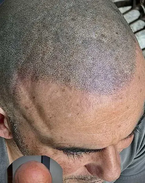 Un primer plano de la cabeza de un hombre con la cabeza rapada.