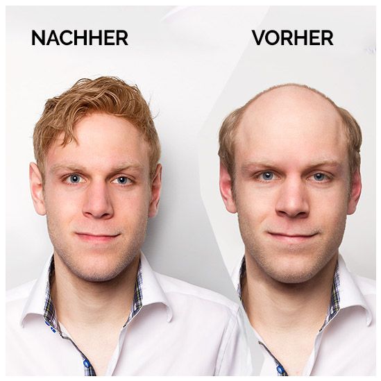 Herren - Vorher und Nachher
