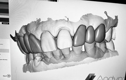radiologie dentaire