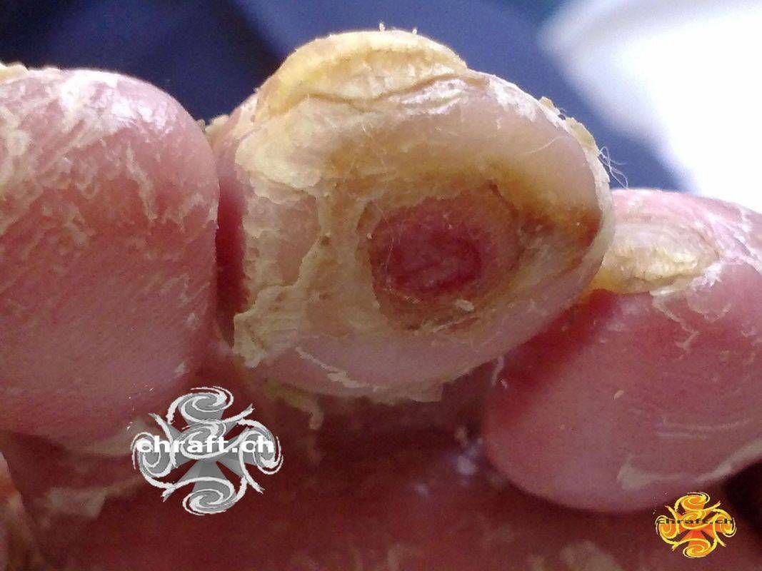 Medizinische Fusspflege