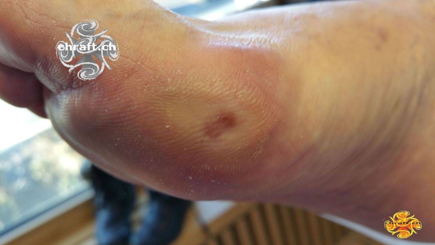 Medizinische Fusspflege