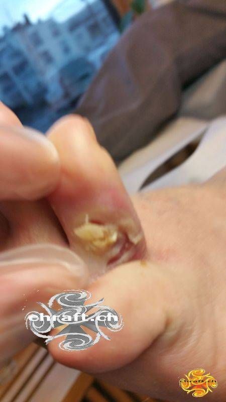 Medizinische Fusspflege