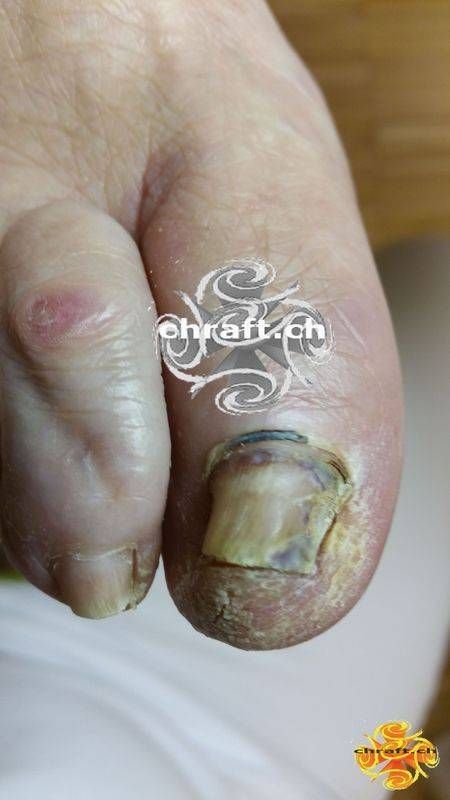 Medizinische Fusspflege