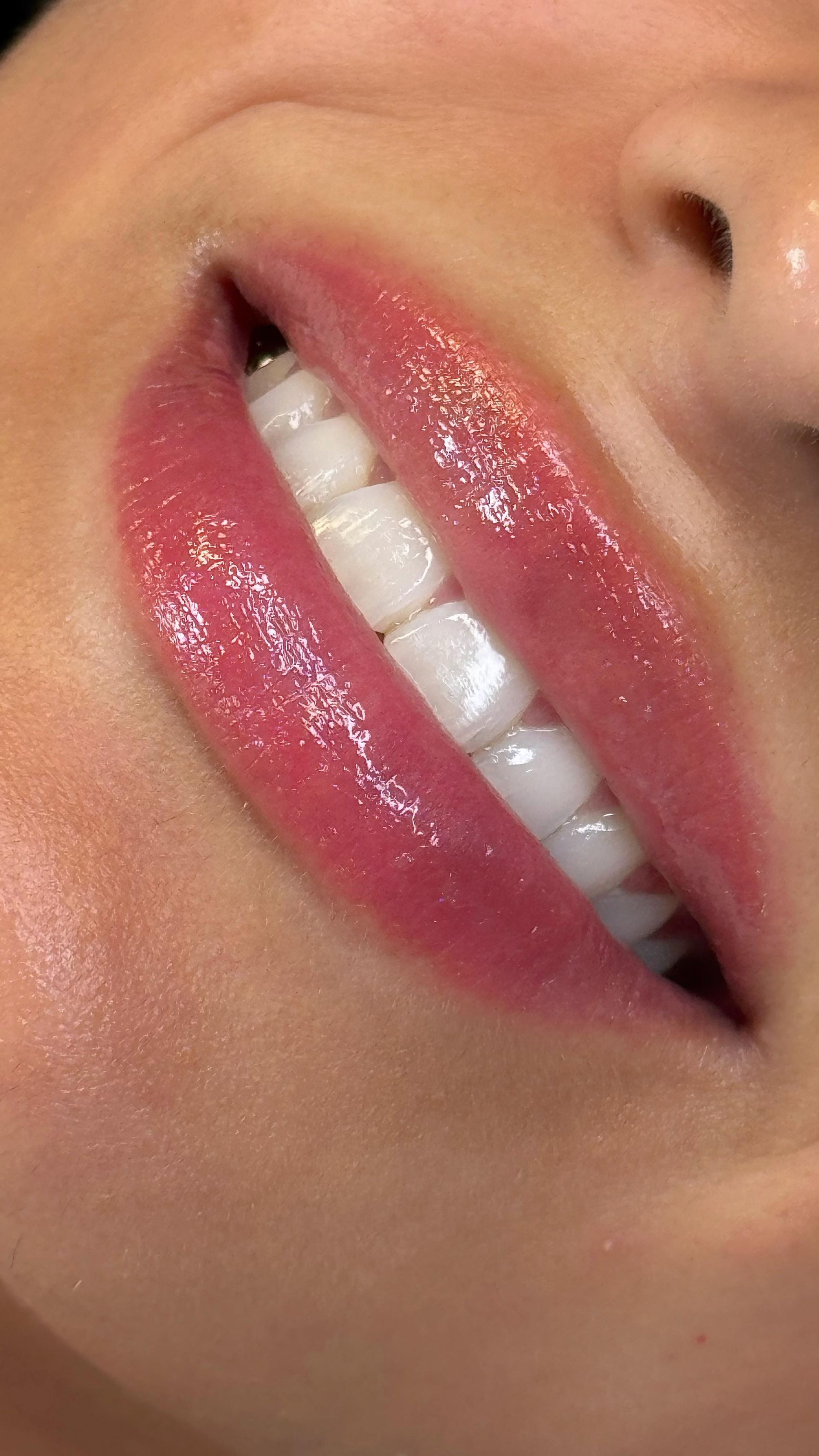 Un primer plano de los labios de una mujer con lápiz labial rosa y dientes blancos.