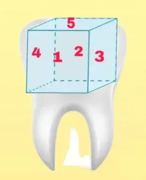 Un cubo etiquetado con los números del 1 al 5 encima de un diente blanco.