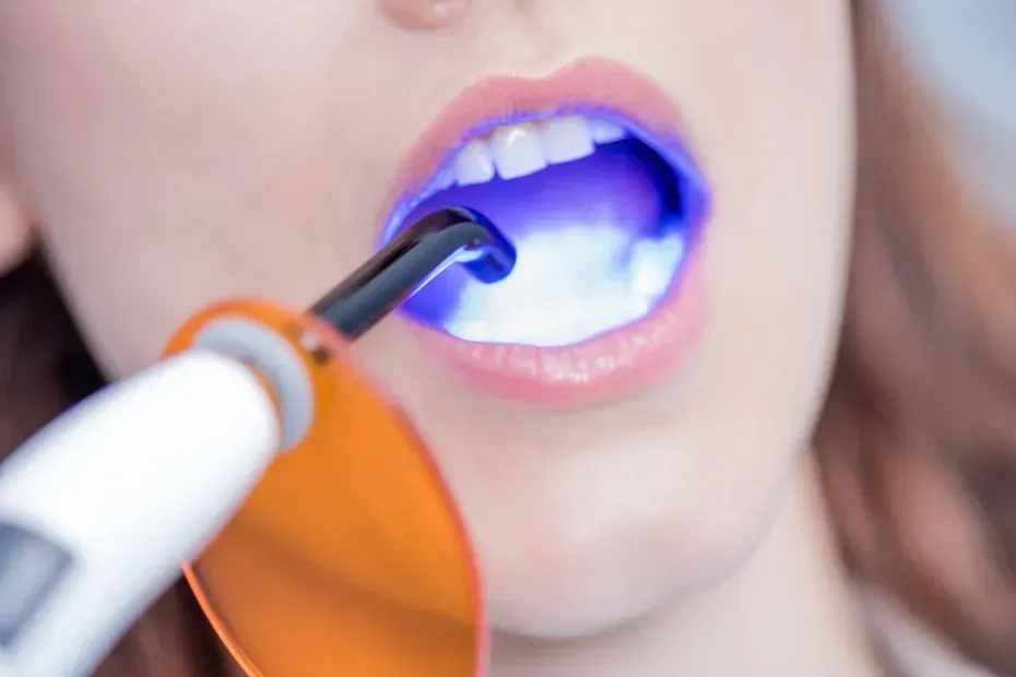 Tratamiento dental: una boca abierta con una luz azul que brilla sobre los dientes.