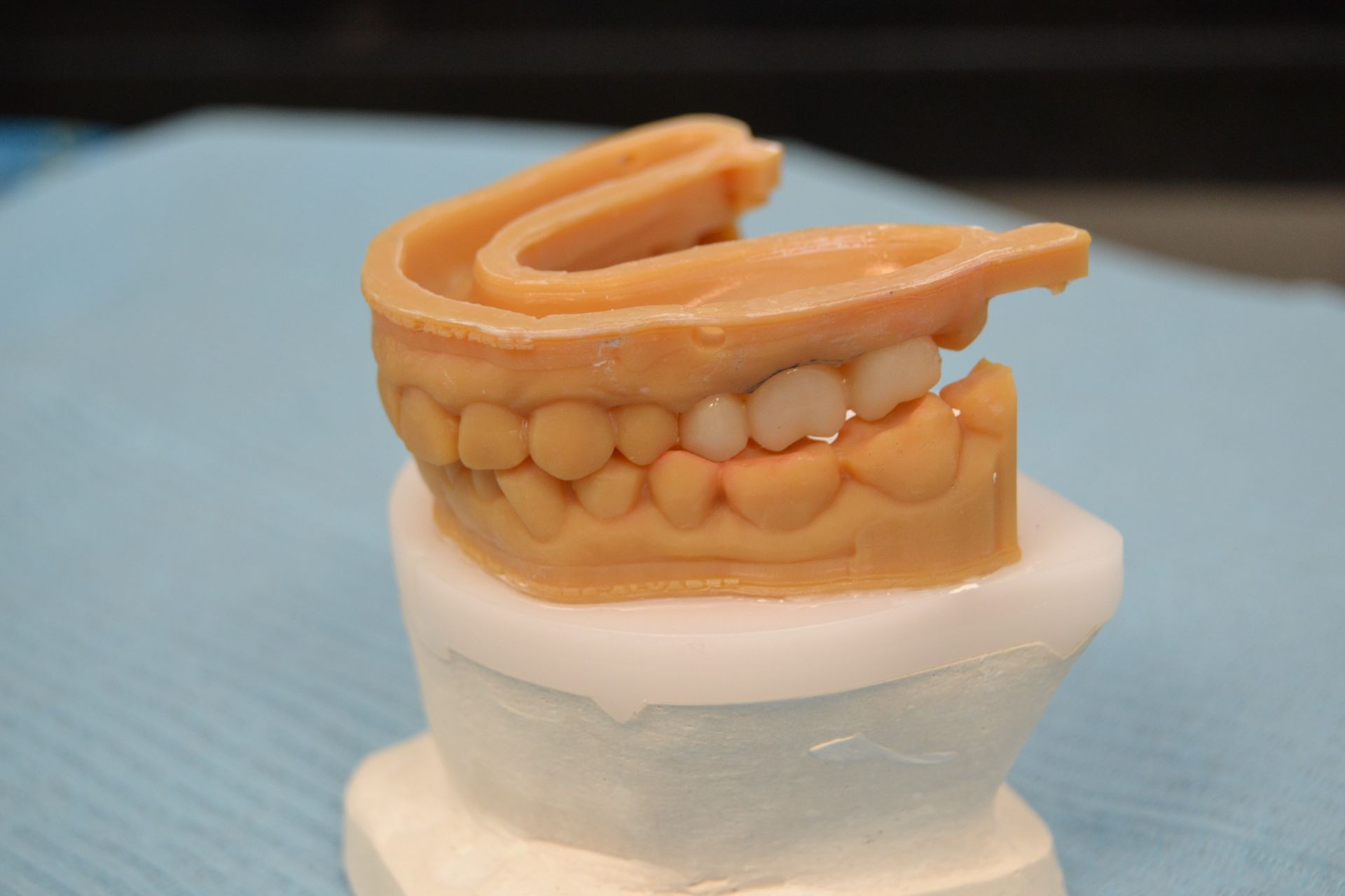 Dentaduras postizas con dientes colocados en plástico rosa, apoyados sobre una base blanca, sobre una superficie azul.