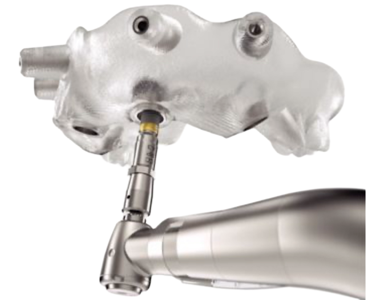 Una guía dental transparente unida a un taladro manual, utilizada para la colocación de implantes.