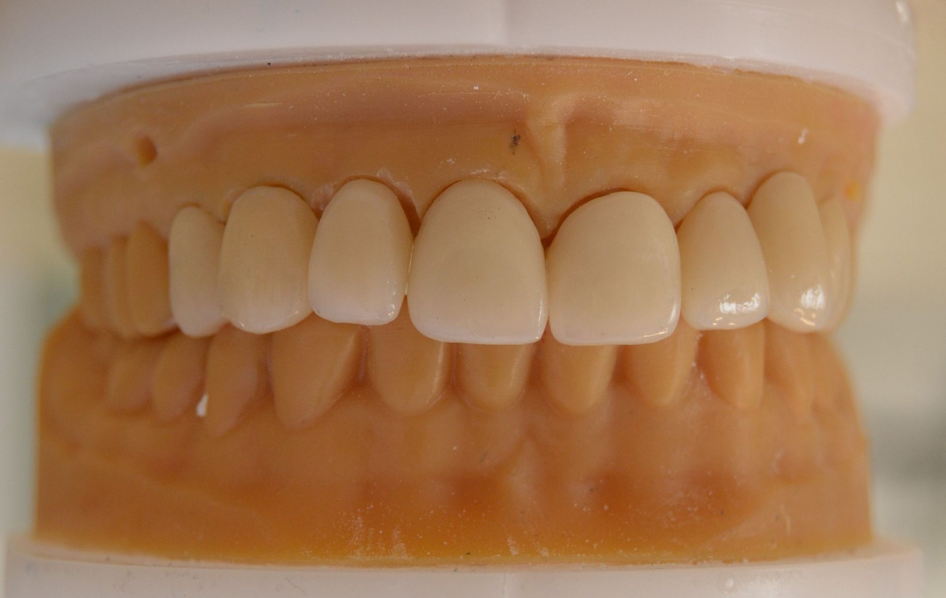 Modelo dental con filas de dientes superior e inferior; dientes artificiales de color crema colocados sobre una base similar a la encía.