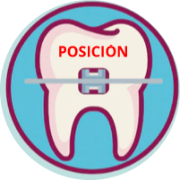 Un diente con un bracket, un alambre y la palabra 