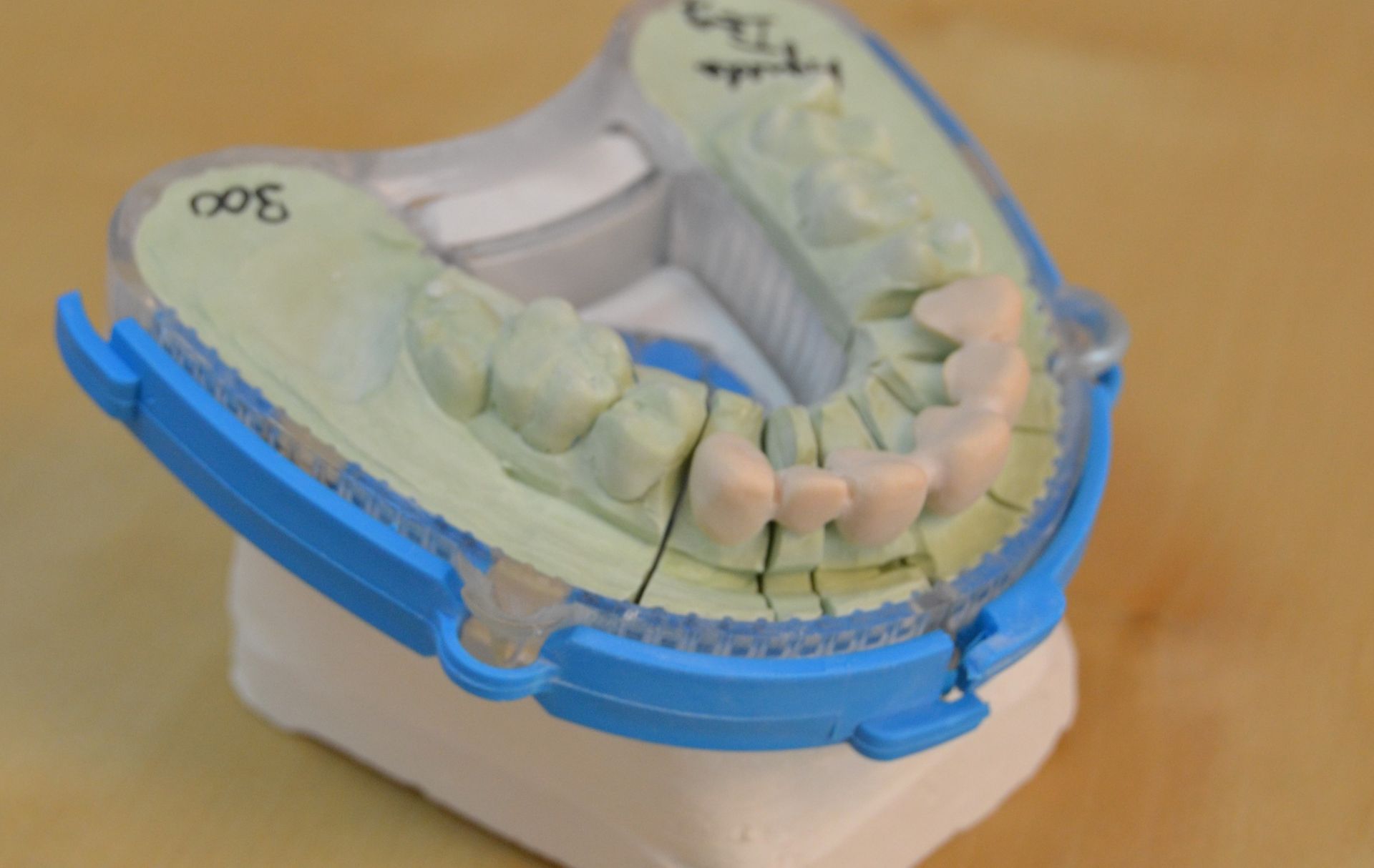 Modelo dental de dientes en un soporte de plástico azul y transparente sobre una base blanca.