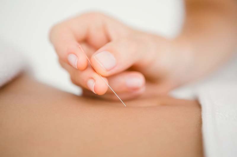 Mano insertando una aguja de acupuntura en la piel.