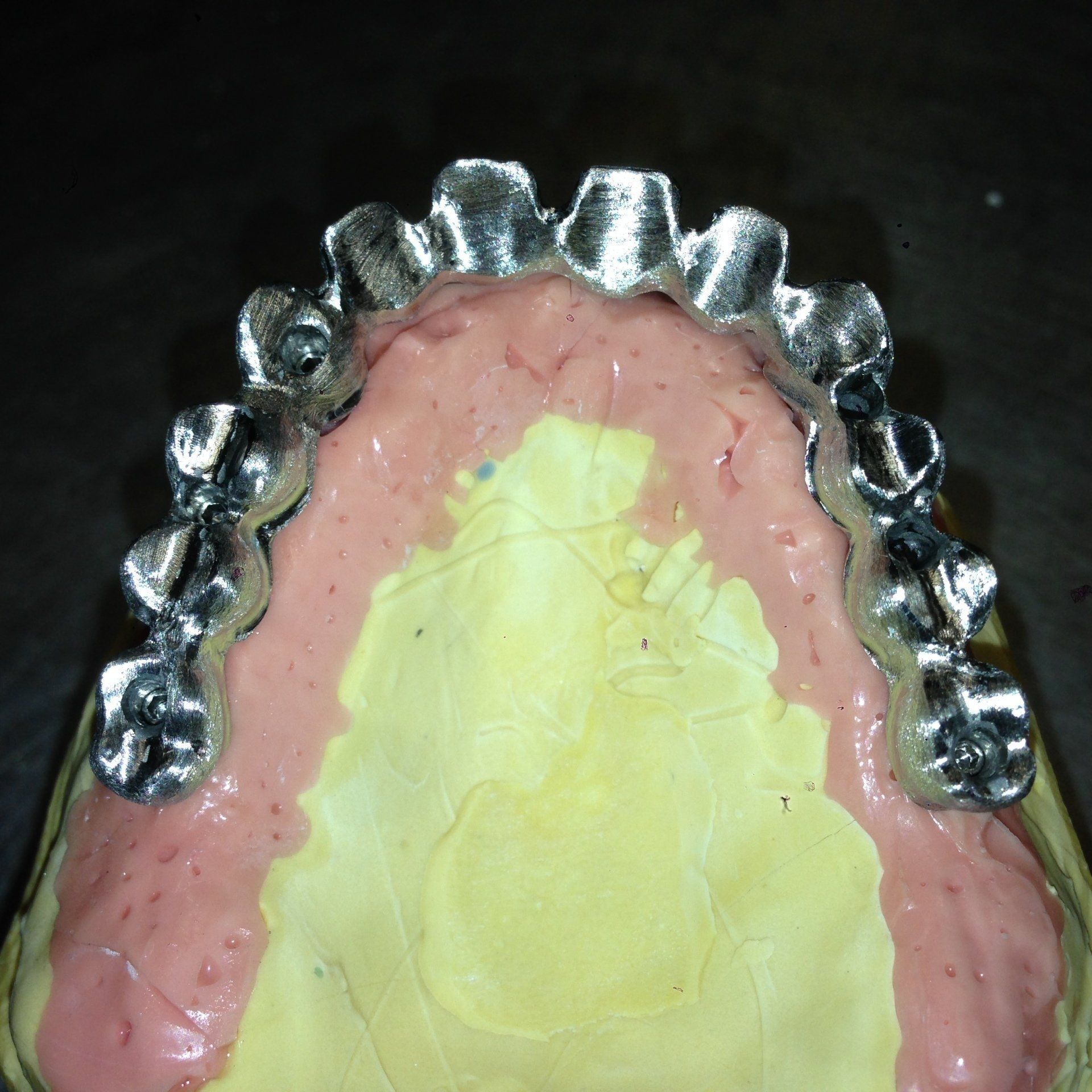 Bridge complet transvissé