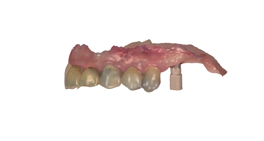 Scan body optique vest