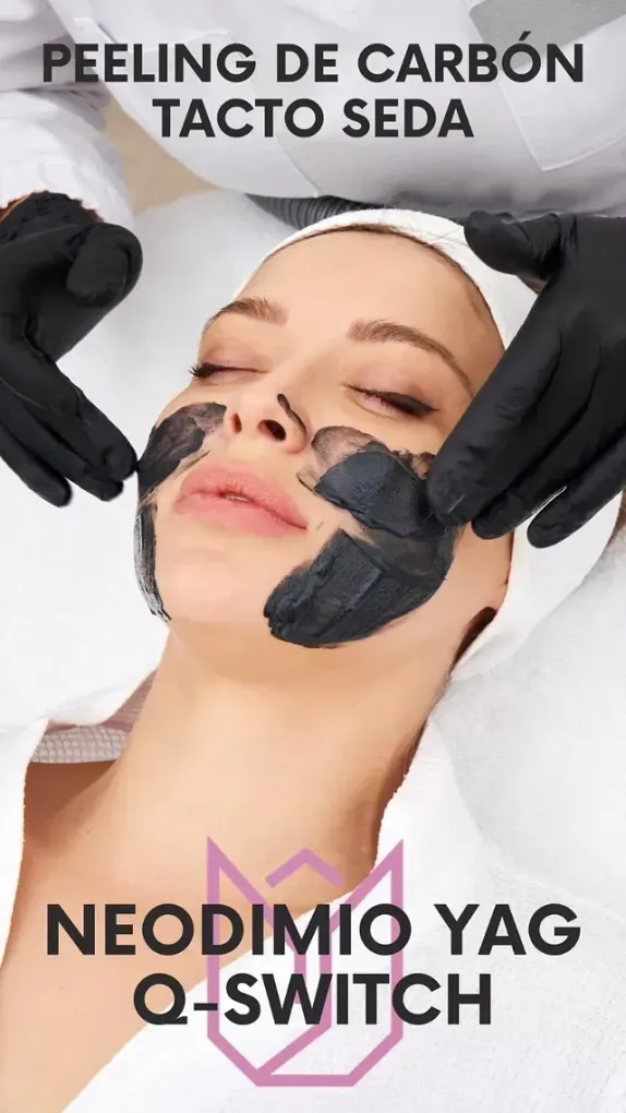 Una mujer se está haciendo un tratamiento de peeling de carbón en la cara.
