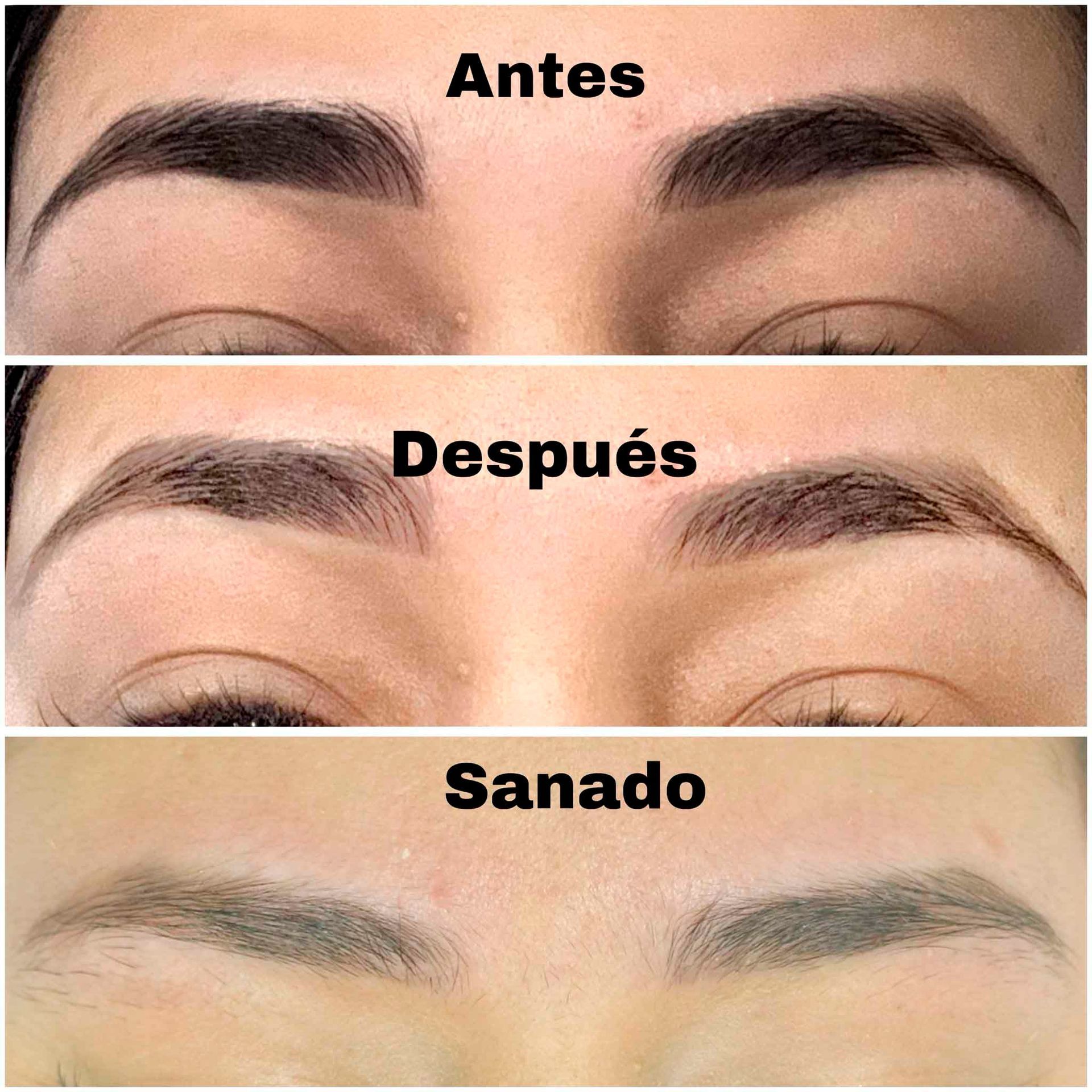 Una fotografía de antes y después de las cejas de una mujer.