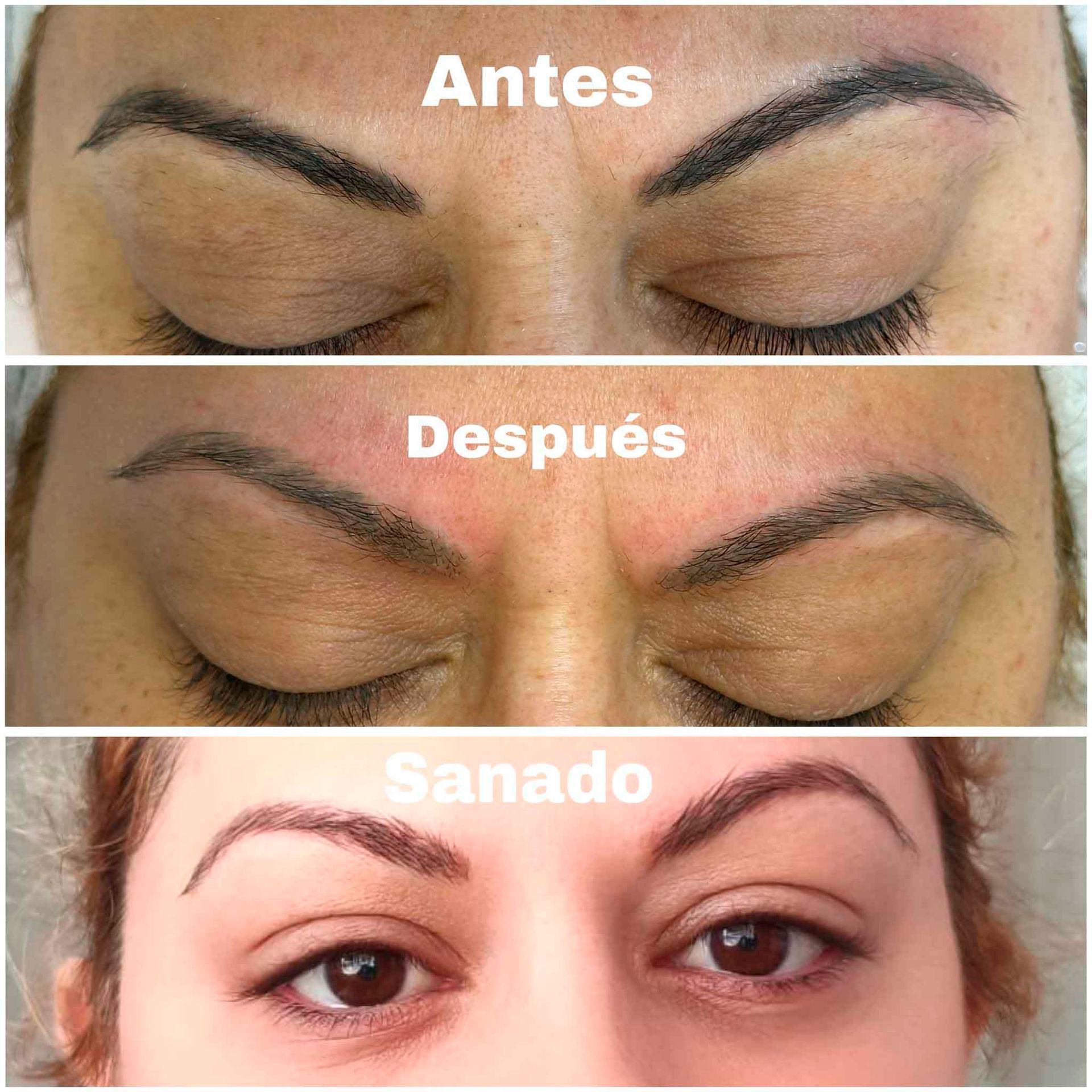 Una foto de antes y después de las cejas de una mujer.