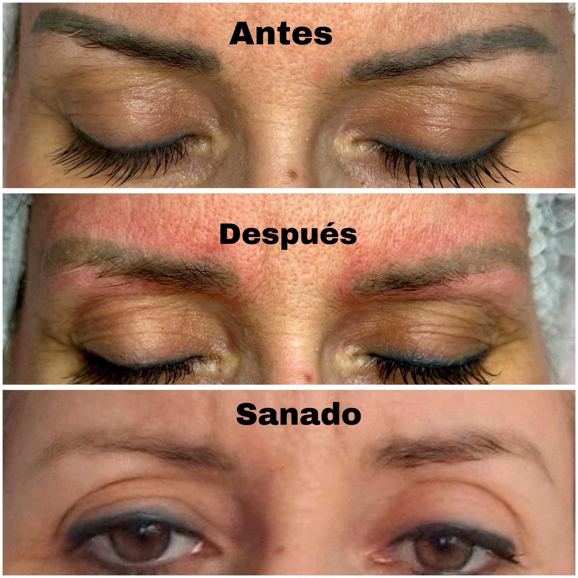 Una foto de antes y después de las cejas de una mujer.