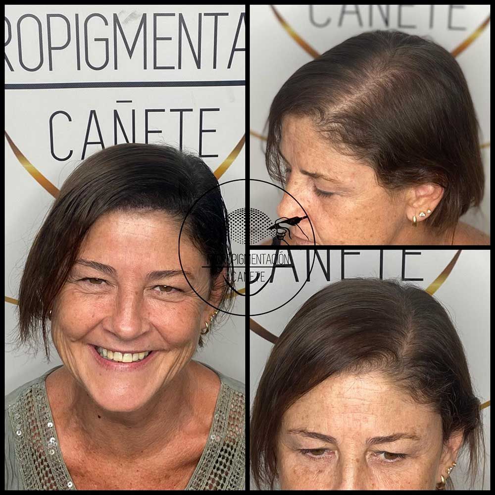 Una mujer sonríe en un collage de antes y después de un tratamiento capilar. El cabello luce más oscuro y abundante.