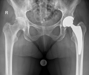 Röntgenaufnahme [company name]