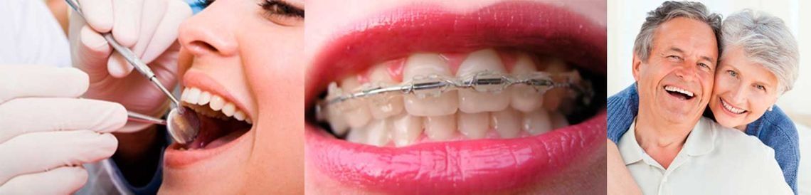 Collage dental que muestra limpieza dental, aparatos de ortodoncia y una pareja mayor sonriente.