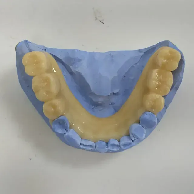Un modelo de los dientes de una persona está sentado sobre una superficie blanca.