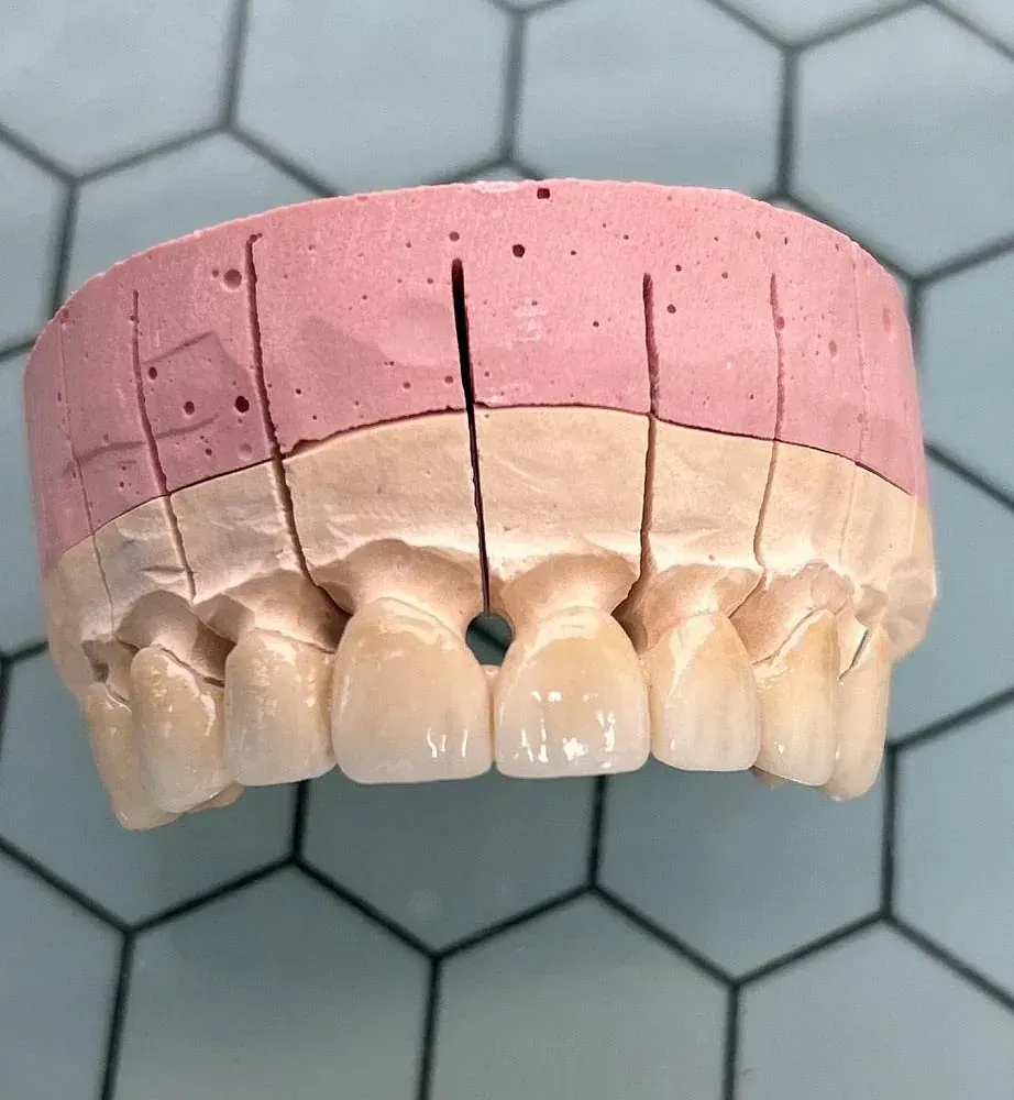 Un modelo de los dientes de una persona con un agujero en el medio.