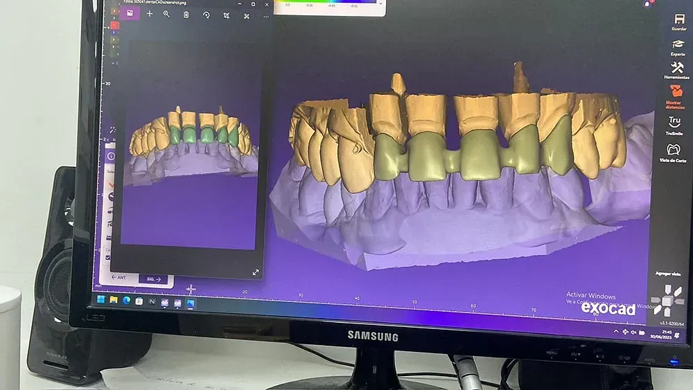 Un monitor de computadora muestra un modelo 3D de los dientes de una persona.