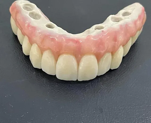 Un primer plano de una dentadura postiza sobre una mesa.