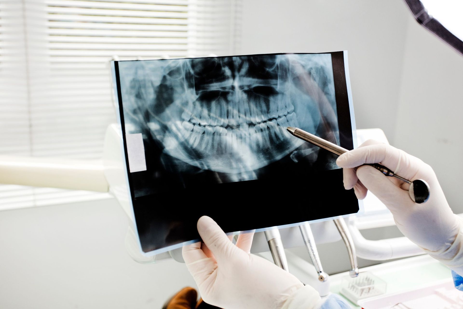Un dentista está mirando una radiografía de los dientes de un paciente.