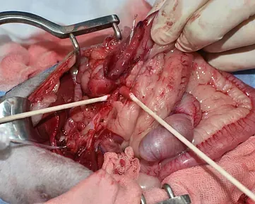 Campo quirúrgico de abdomen abierto. Se observan los órganos internos, sujetos con retractores. 