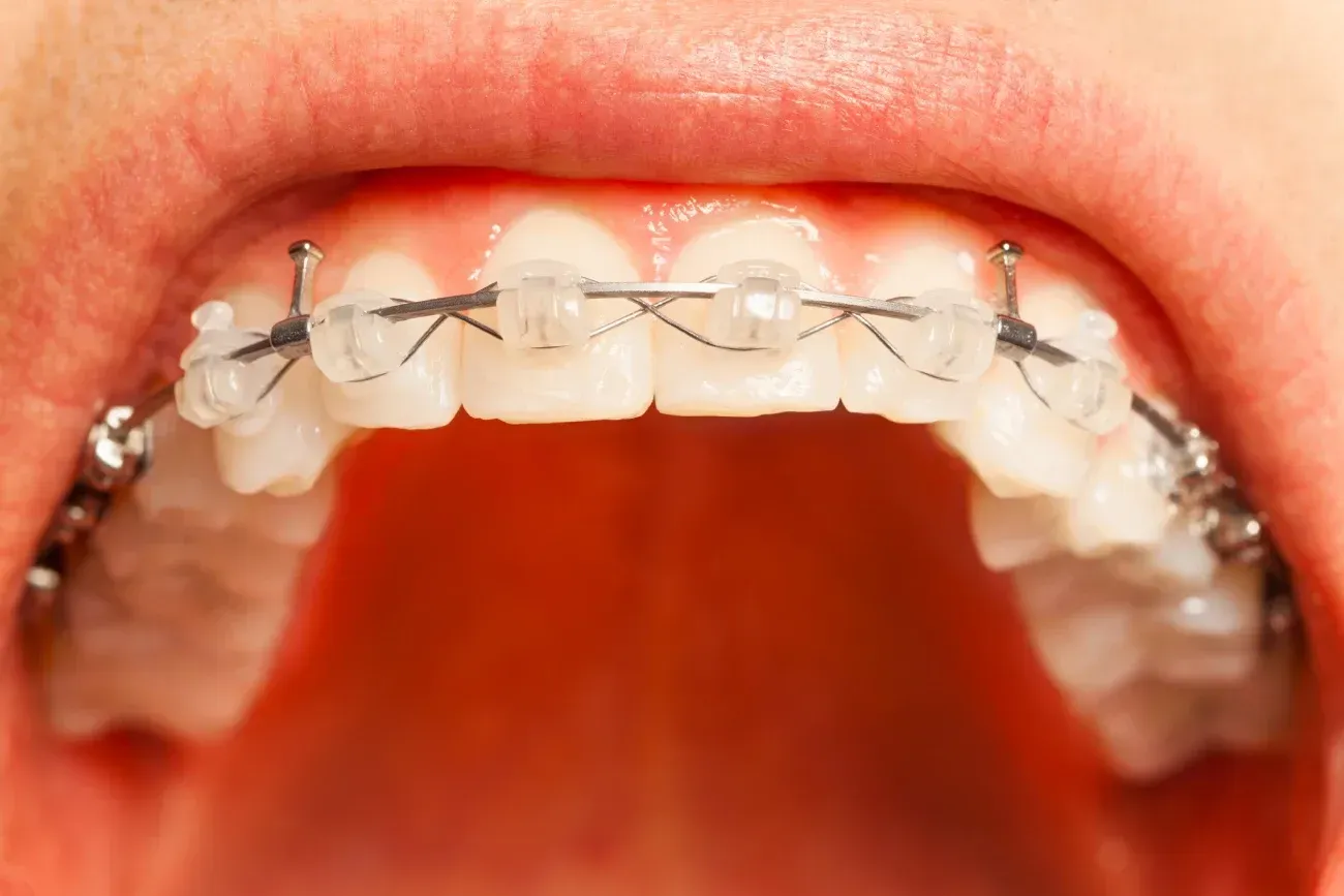 Una niña está parada frente a una máquina dental.