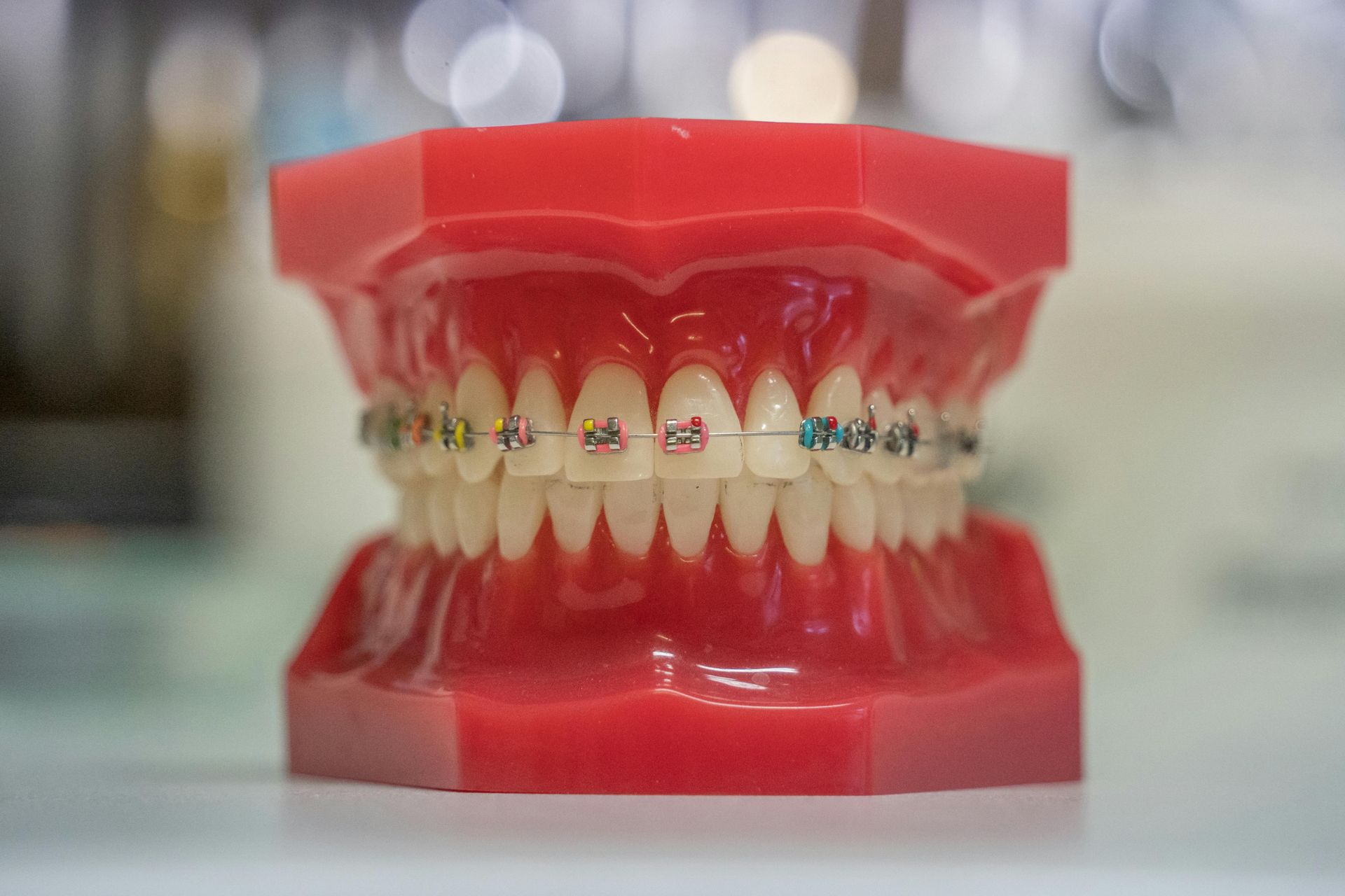 Un primer plano de un modelo de los dientes de una persona con aparatos ortopédicos.