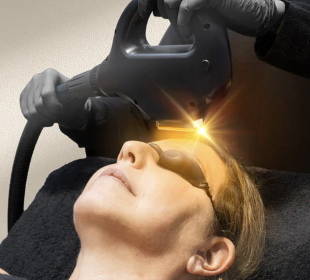 Una persona que lleva gafas protectoras recibe un tratamiento facial a base de luz mediante un dispositivo portátil.