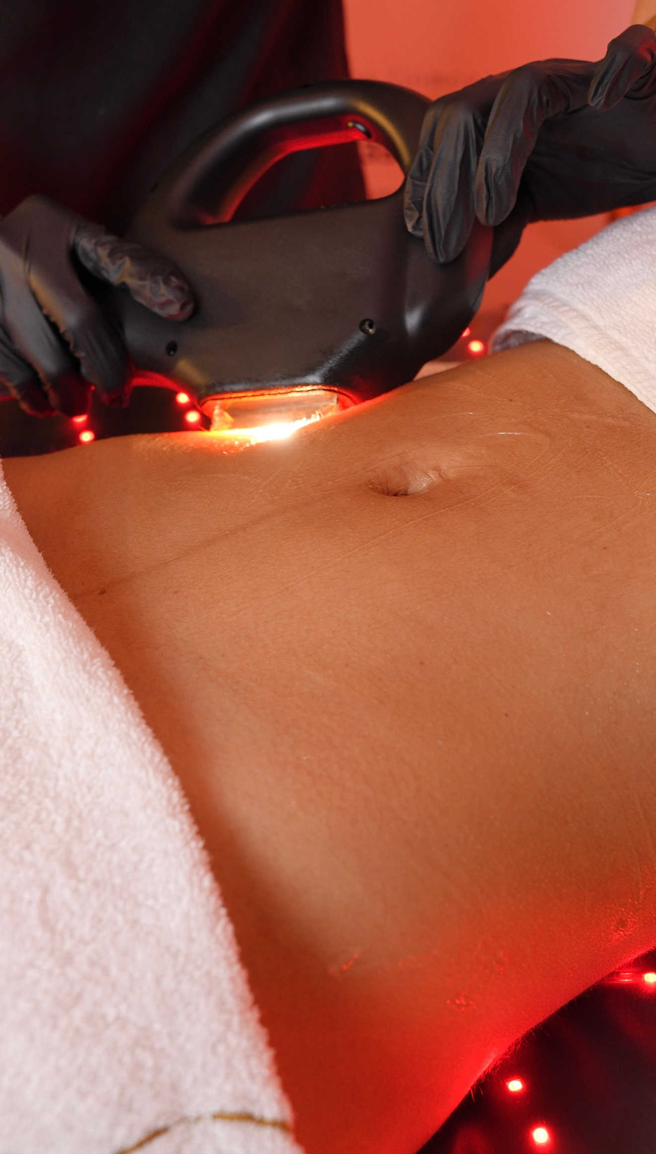 Manos enguantadas que utilizan una luz roja brillante sobre el abdomen descubierto de una persona durante un tratamiento.