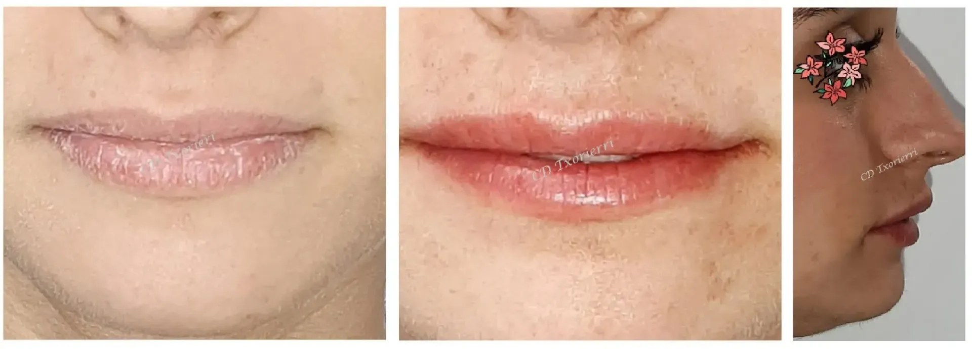 Los labios de una mujer se muestran en tres ángulos diferentes.