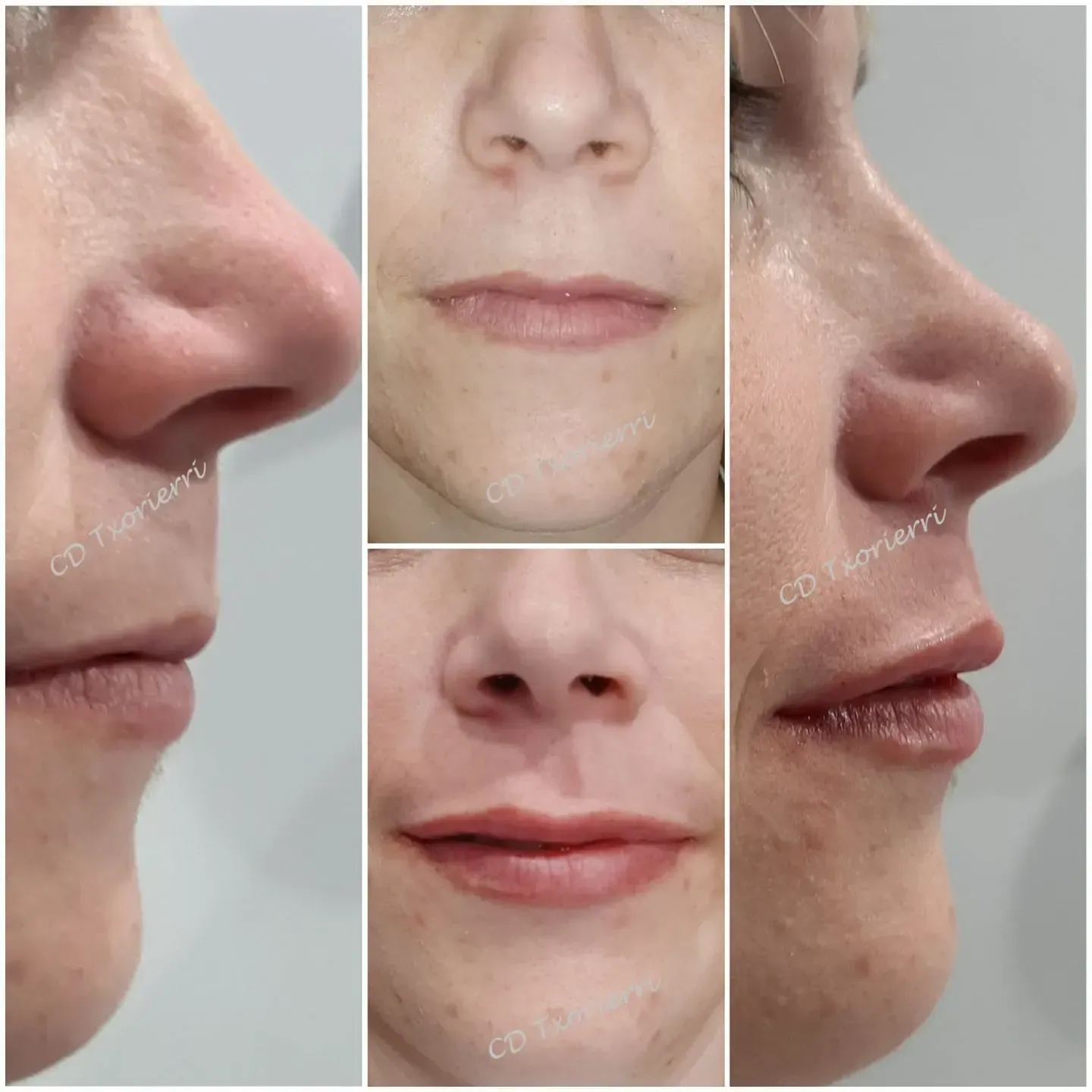 Un collage de tres fotografías de la nariz y los labios de una mujer.