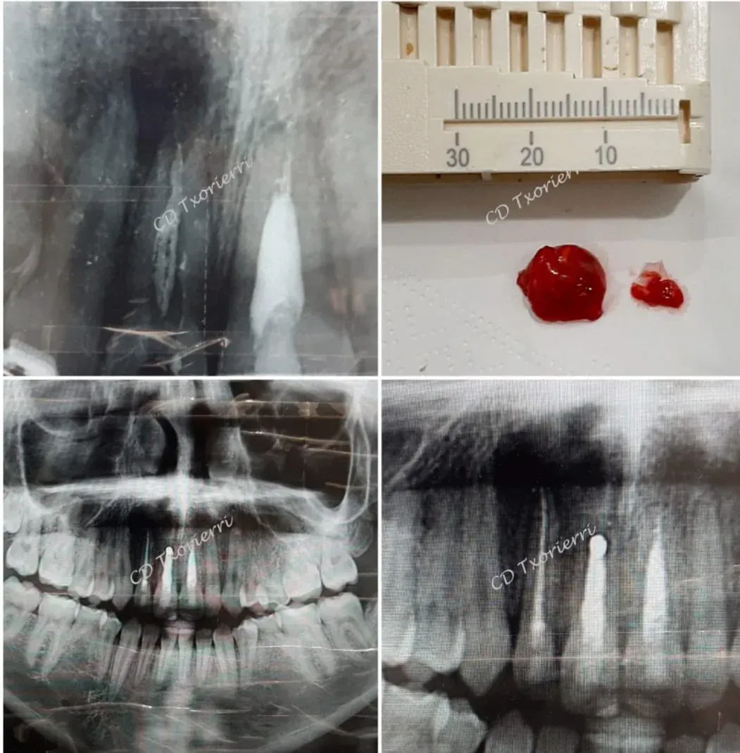 Un collage de radiografías de los dientes de una persona y una regla.
