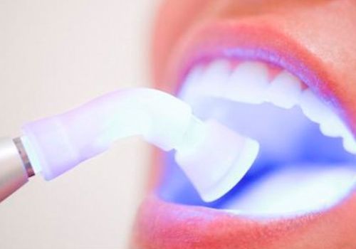 Una mujer se está blanqueando los dientes con una luz.