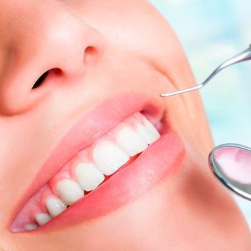 Una ilustración de un implante dental entre dos dientes.