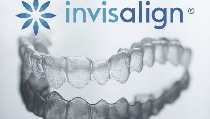 Una imagen de una boca con brackets Invisalign.