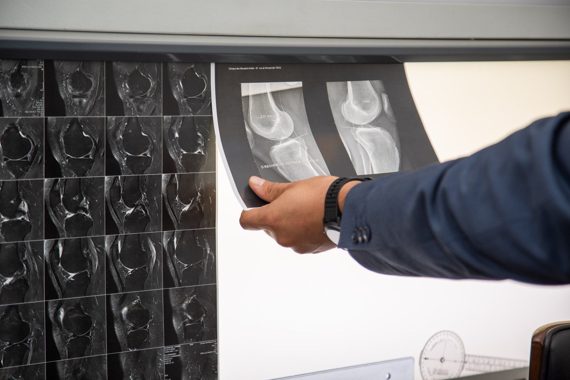 Un médecin examine une radiologie