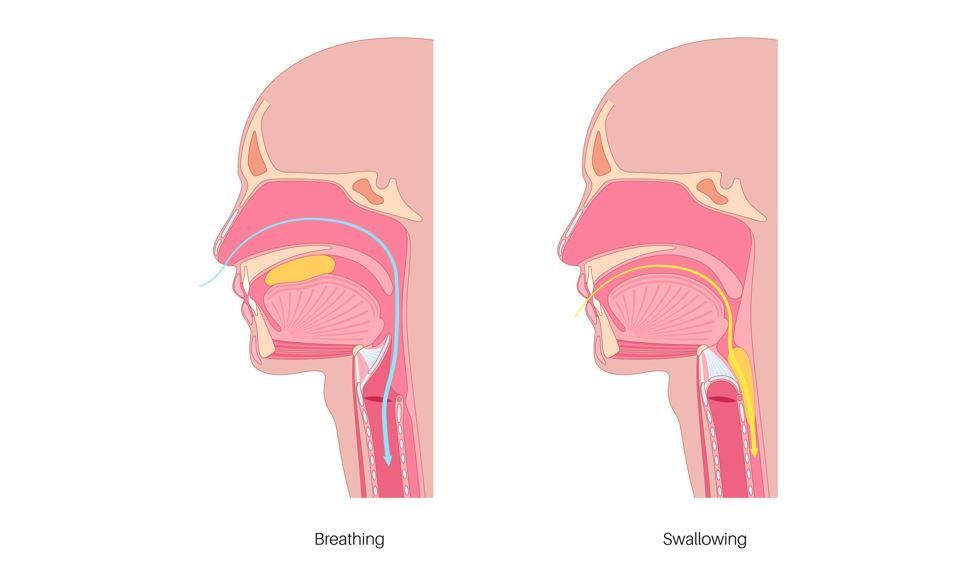 Diagramas comparativos: 