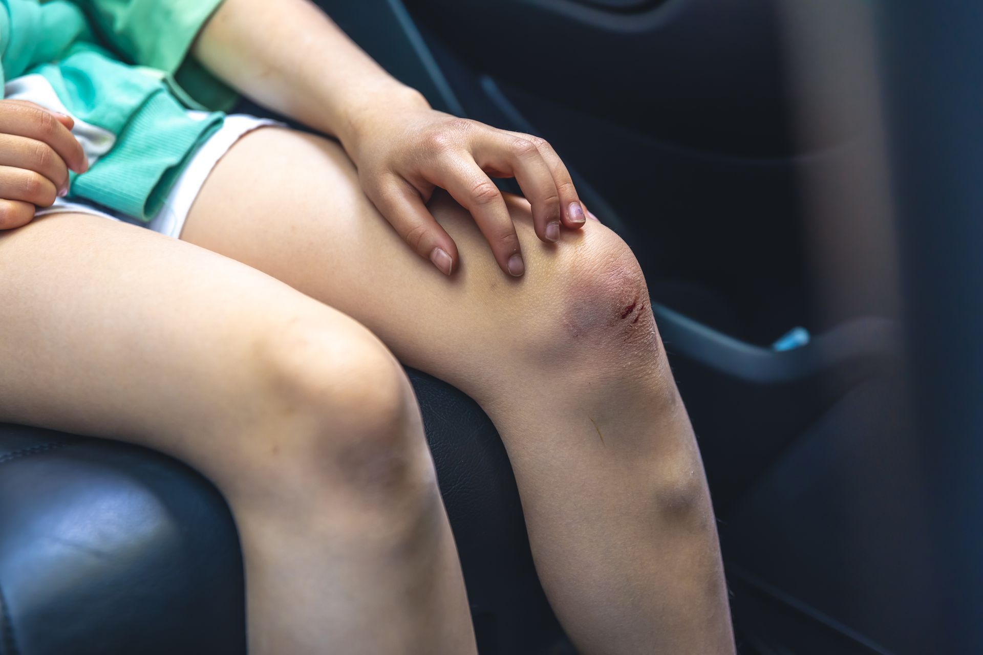 Genou présentant une petite abrasion superficielle et des contusions
