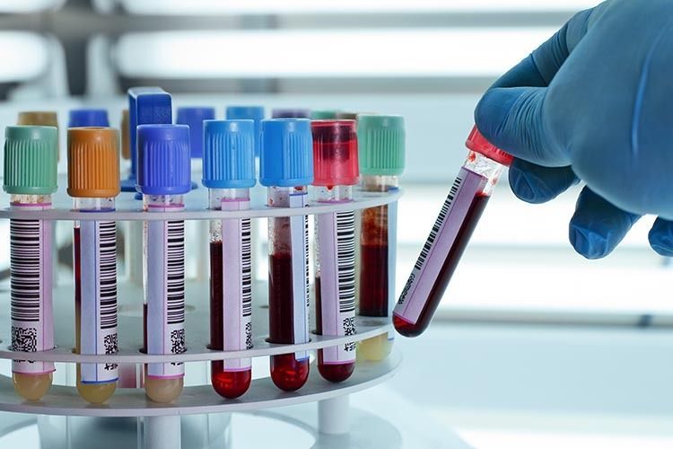 Una mano enguantada sostiene un tubo de ensayo junto a un estante con coloridas muestras de sangre en un laboratorio.