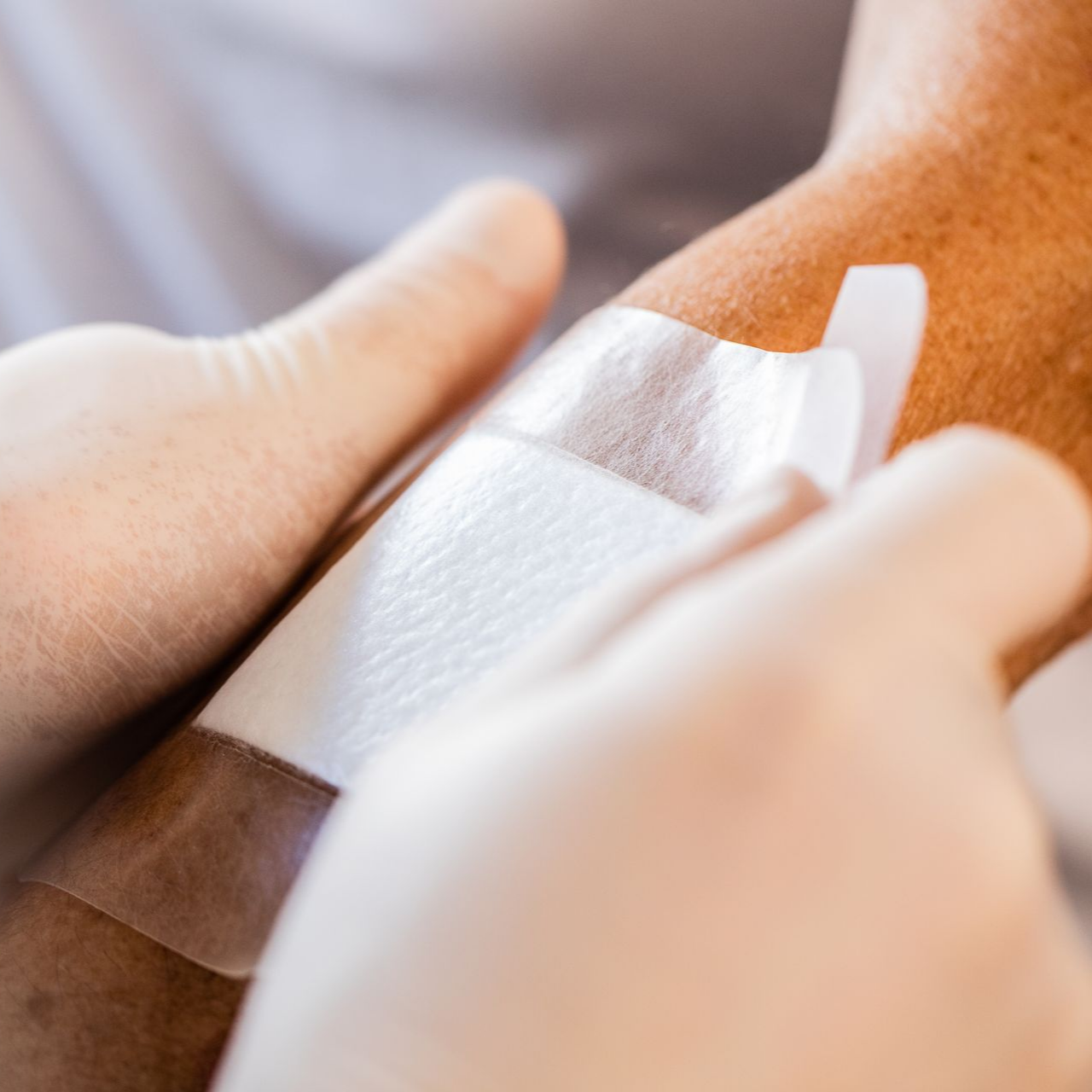 Des mains gantées appliquent un pansement adhésif blanc sur le bras d'un patient.